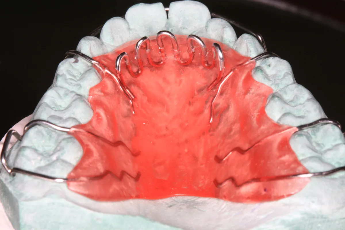 Thumb Sucking Habit Appliance