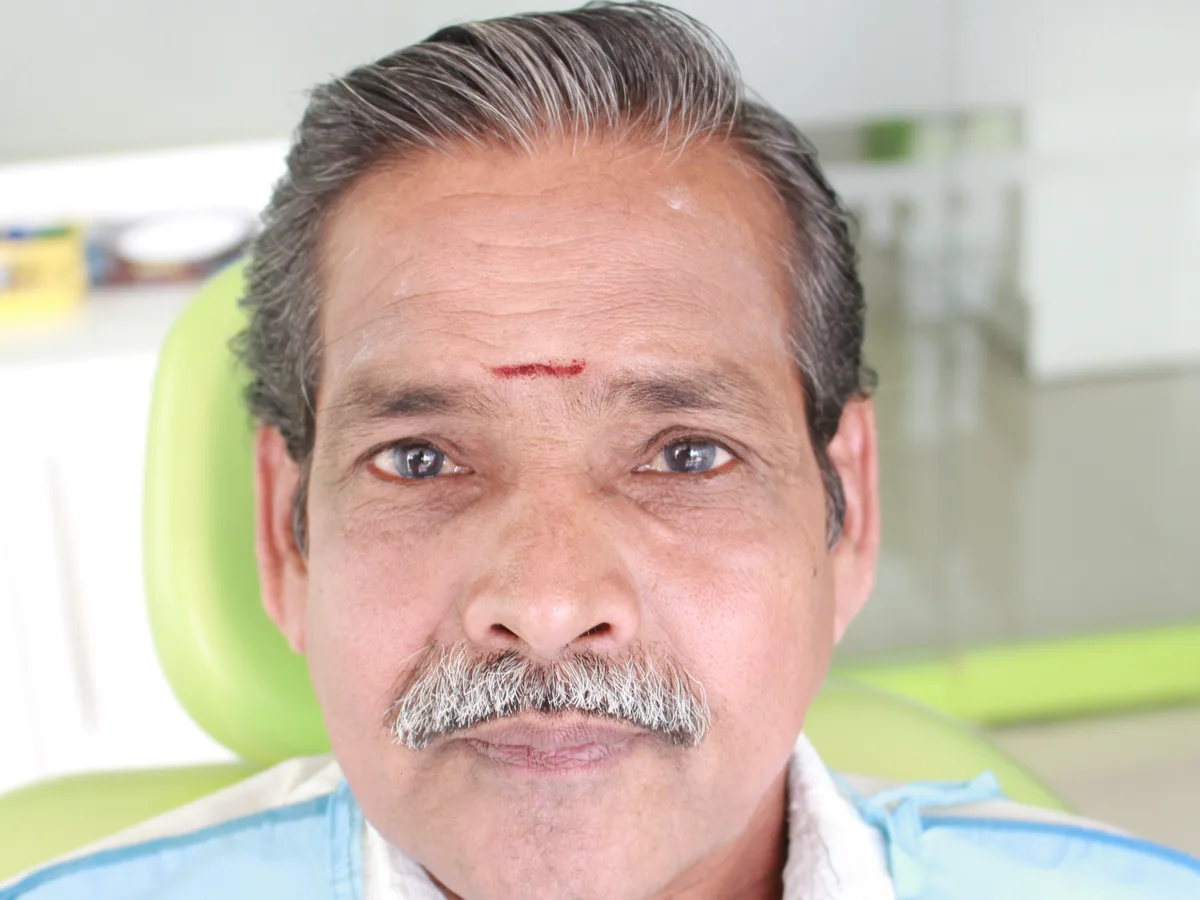 BPS Precision Dentures