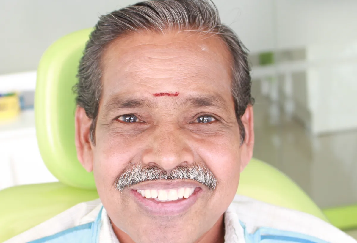 After — BPS Precision Dentures